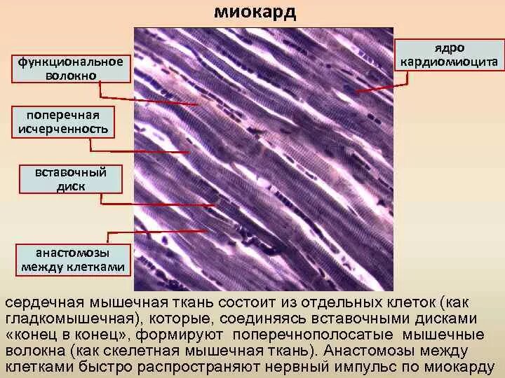 Состоит из клеток имеющих поперечную исчерченность. Сердечная мышечная ткань гематоксилин эозин. Сердечная поперечнополосатая мышечная ткань миокард лошади. Препарат миокард Железный гематоксилин. Микард гистологии кардиоминоцитв.