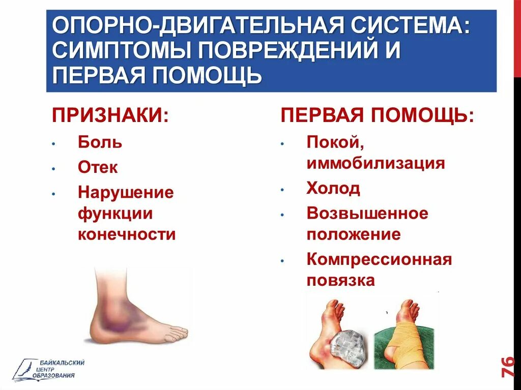 Первые симптомы травм. Причины травм опорно-двигательного аппарата. Признаки повреждения опорно двигательной системы. Виды травм опорно-двигательного аппарата признаки. Первая помощь при травмах опорно двигательного аппарата.