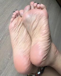 Wrinkled foot