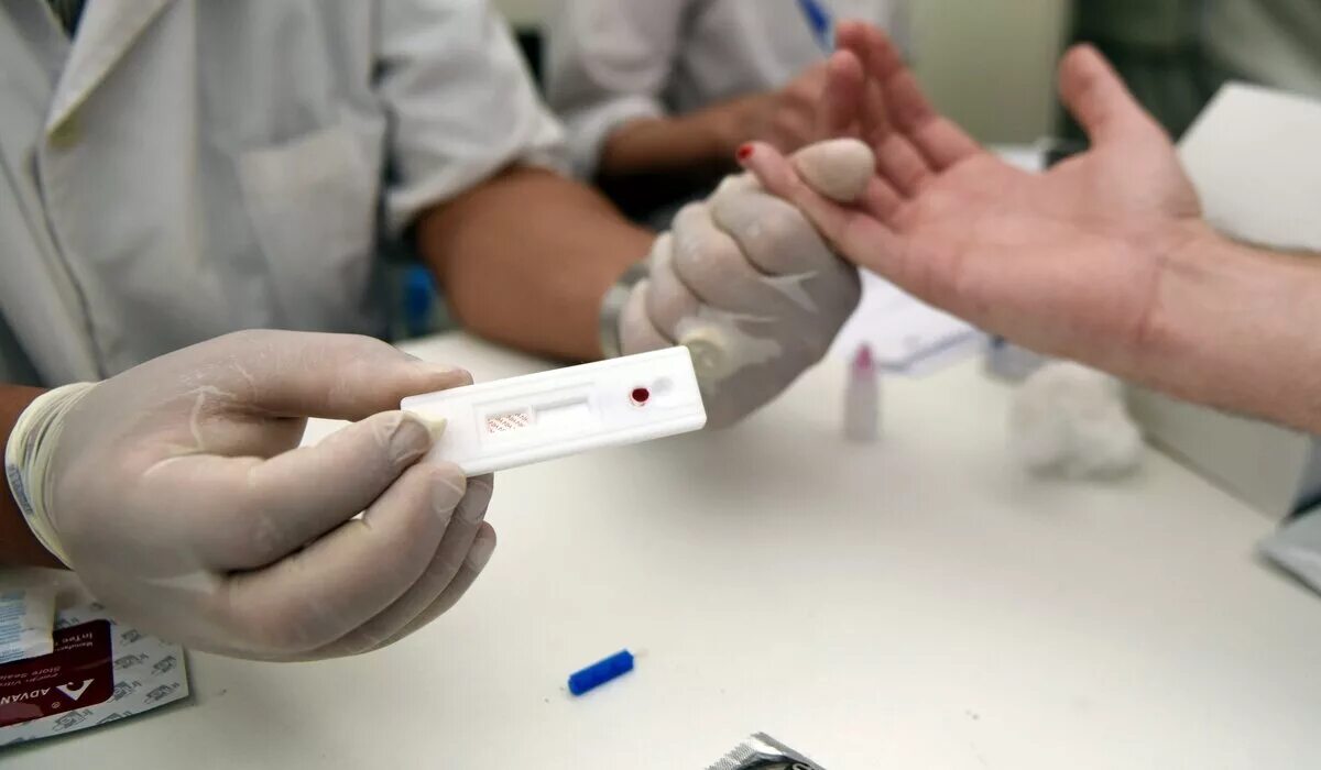 Спид центр кровь. Экспресс-тестирование на ВИЧ-инфекцию. Экспресс-тест на СПИД ВИЧ. Экспресс тест на ВИЧ. Тест на ВИЧ И СПИД.