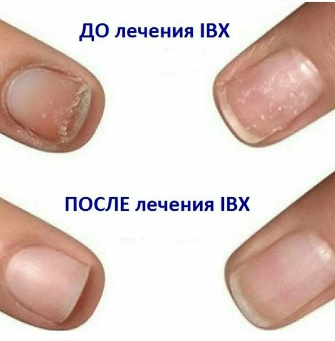 Ногти после IBX. Пропилы на ногтях после аппаратного. Пропилы на ногтях после аппаратного маникюра.