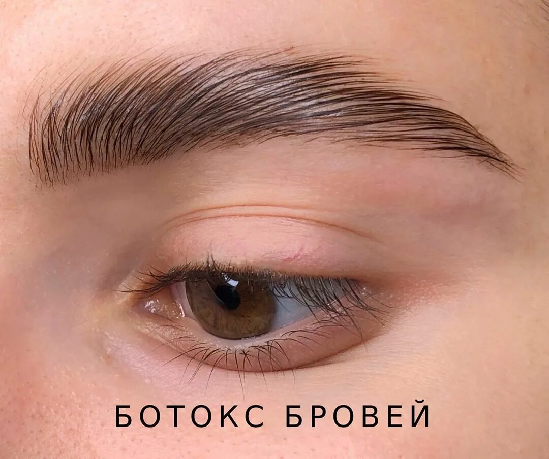 Что такое ботокс бровей. Ботокс для бровей. золотой ботокс для бровей. ботокс для бровей фото.