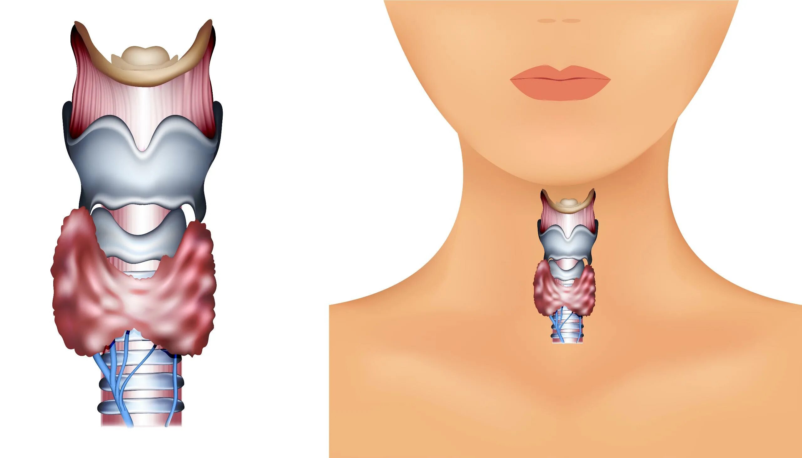Трахея щитовидка анатомия. Щитовидная железа анатомия кадык. Щитовидный хрящ и щитовидная железа. Гортань и щитовидная железа. Зоб в горле
