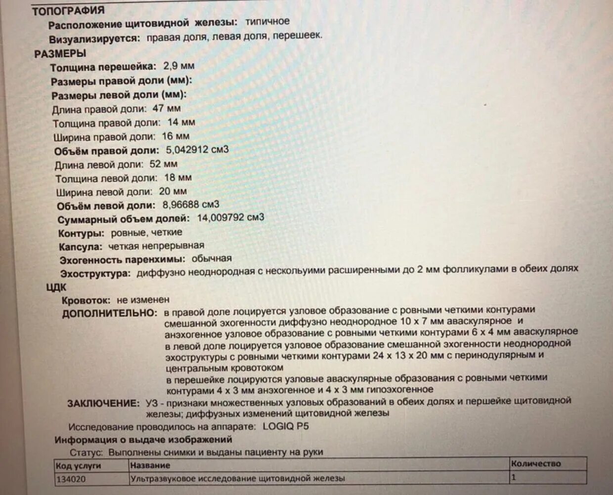 Анализ пункция щитовидной железы. Заключение пункции узла щитовидной железы. пункция щитовидной железы результаты исследования норма.