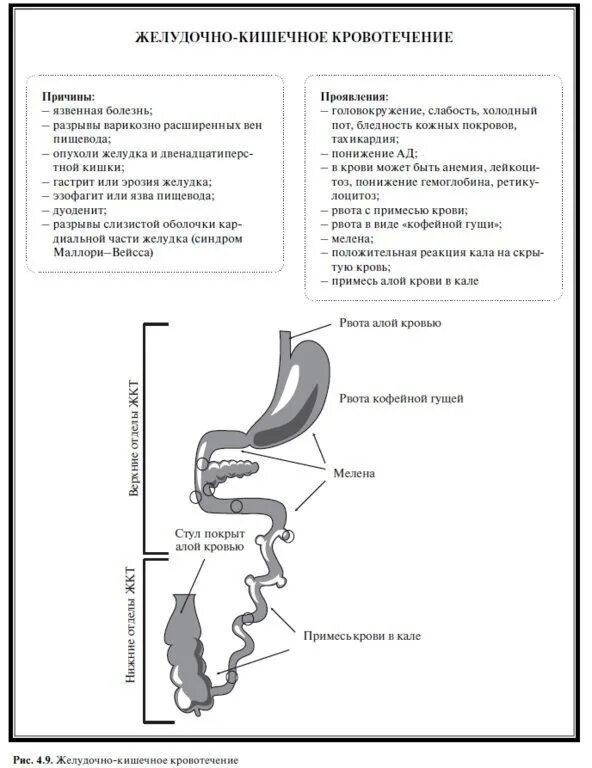 Желудочно кишечные кровотечения итоговые тестирование ответы. Стул при желудочно кишечном кровотечении. Алая кровь в стуле наблюдается при кровотечении из. Кровь в Кале из верхних отделов ЖКТ. Схемы желудочно-кишечных кровотечений.