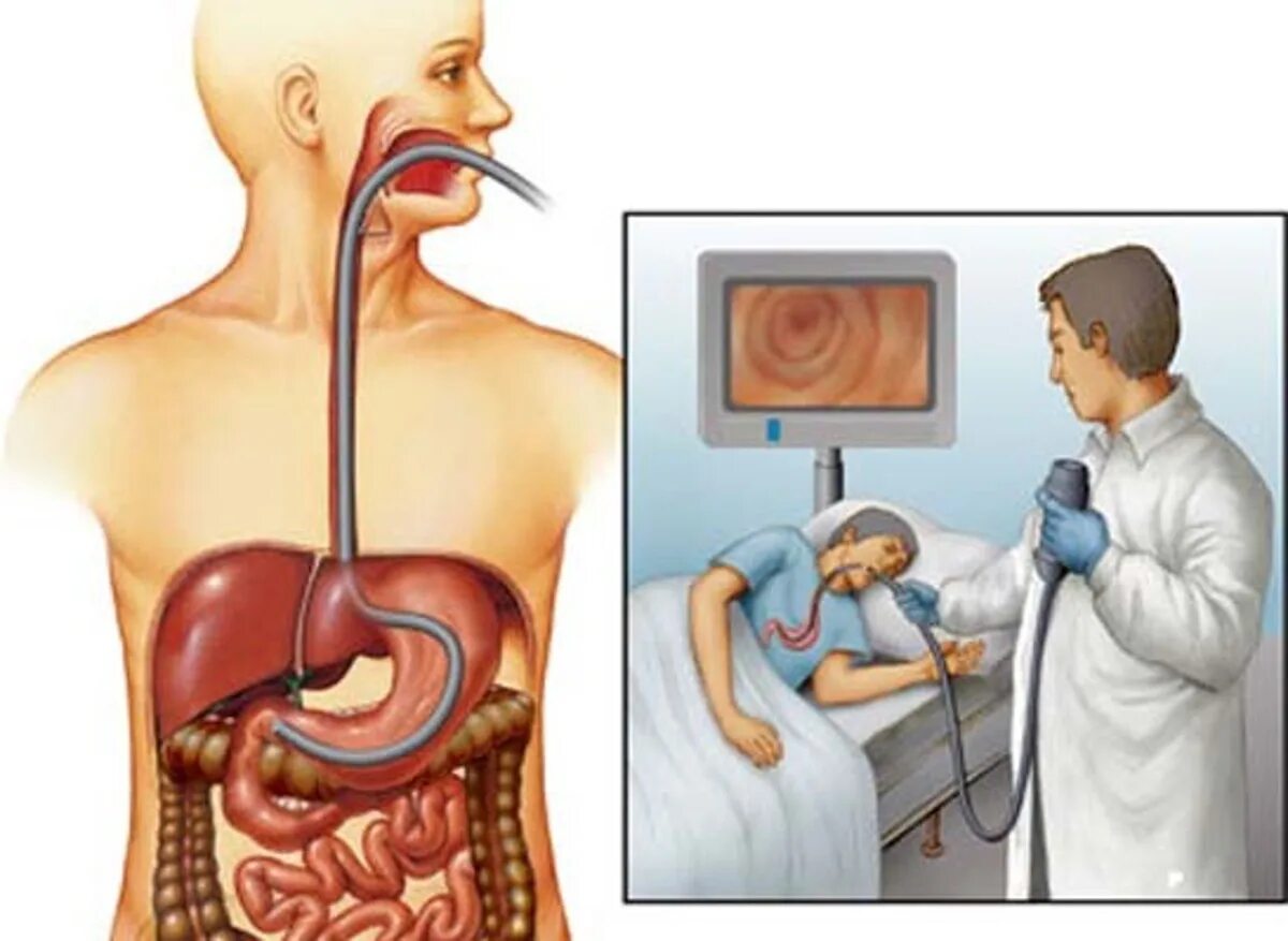 Эндоскопии желудочно кишечного