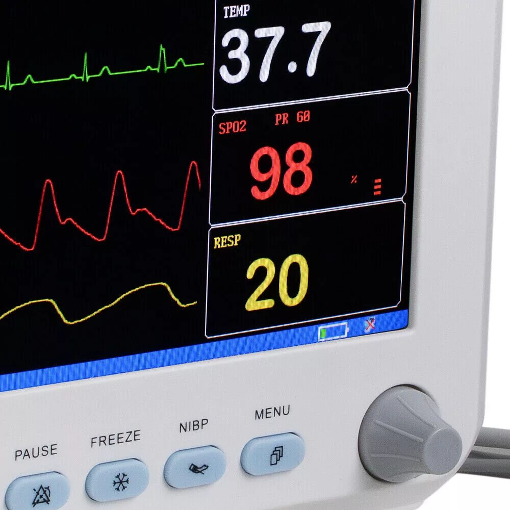 Прибор монитор. Icu Monitor spo2 NIBP resp Temp ECG patirent. Icu Monitor spo2 NIBP resp Temp Patrent. Spo2 NIBP resp Temp ECG. Аппарат для измерения пульса монитор.