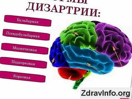 Дизартрия структура