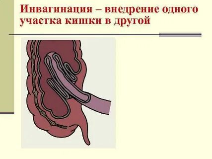 Ректальный кишки