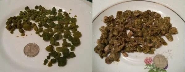 Каловые камни - пора избавляться - Здоровы с нами