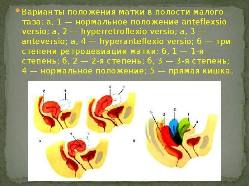 Опущение женских половых органов. Антеверзио антефлексио. Правильное расположение матки в полости малого таза. Нормальное положение матки в тазу. Нормальное положение матки в Малом тазу.