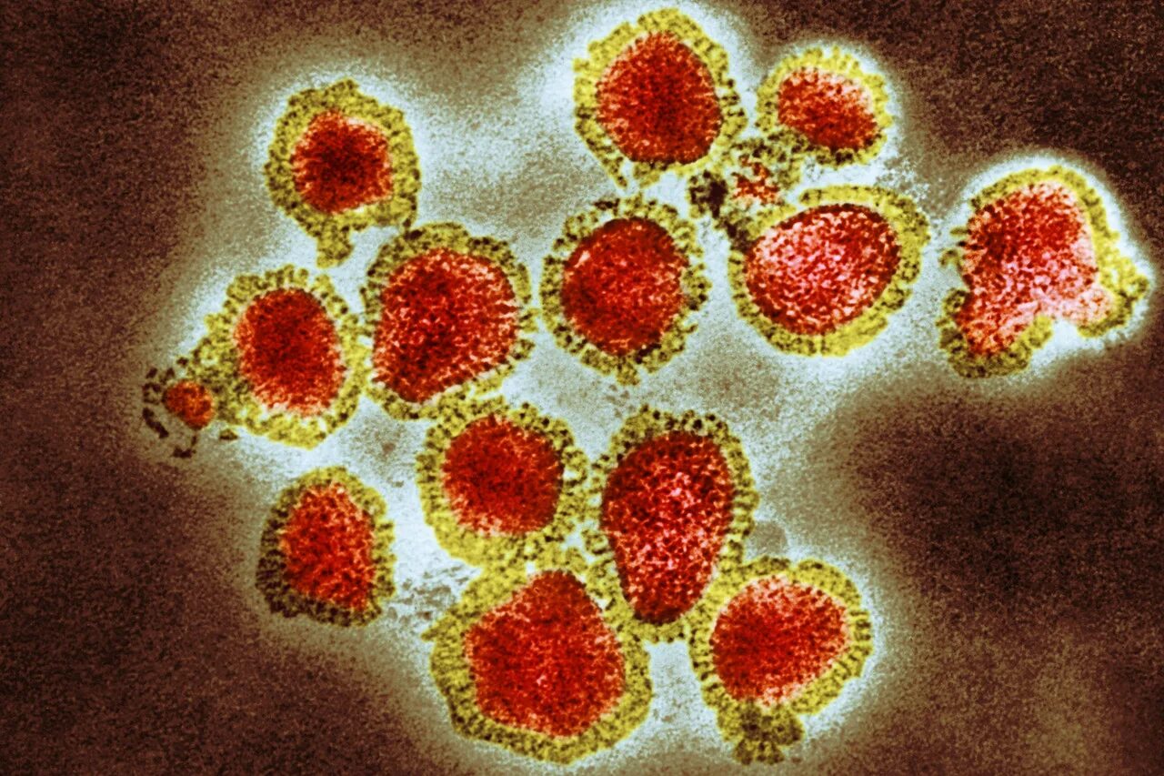 Симптомы гонконгского гриппа у взрослых в 2025. Вирус h3n2. азиатский грипп h2n2 вирус. вирус гриппа h3n2. гонконгский грипп h3n2.
