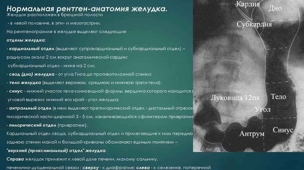 Проксимальной слабости. Пилорический отдел желудка рентген. Строение желудка рентген. Отделы желудка анатомия рентген. Рентген анатомия желудка в норме.