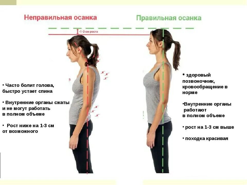 Почему неправильно. Правильная осанка. правильная и неправильная осанка. правильное и неправильное положение осанки. как правильно держать осанку.