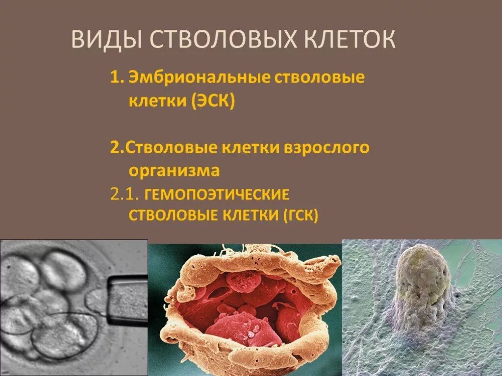 Фетальные стволовые клетки. Стволовые клетки презентация. Стволовые клетки эмбриона в медицине.