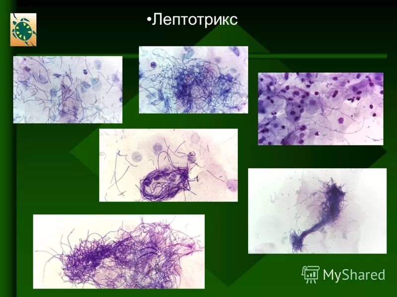 Лептотрикс лечение. Бактерии типа leptotrix в мазке. Лептотрикс ключевые клетки. Лептотрикс микроскопия. Лептотрикс кокки.