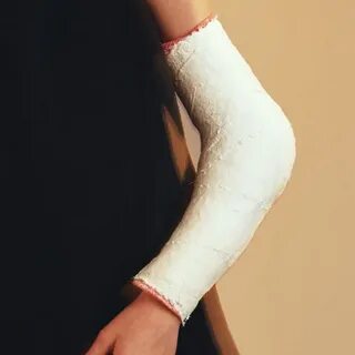 She has broken her leg