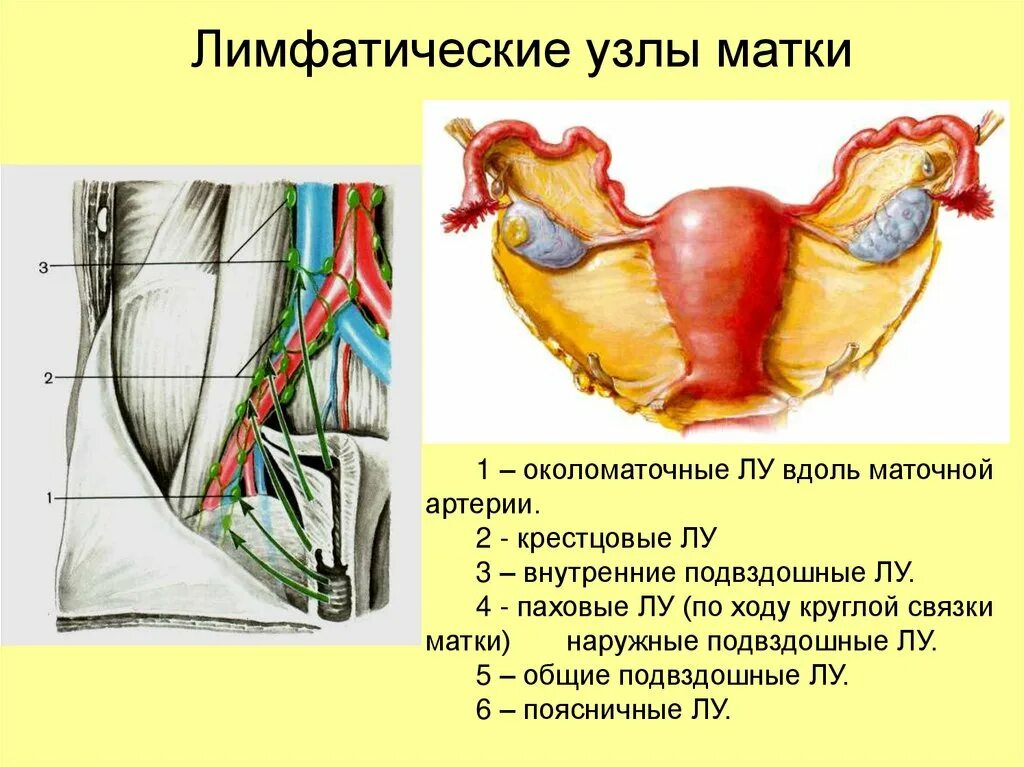 Региональные лимфатические узлы матки. Артерия круглой связки матки. Расположение лимфоузлов таза. Лимфоузлы и удаление матки