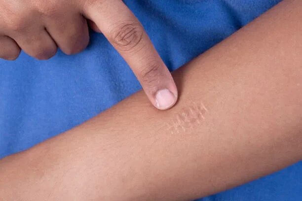 Как выглядит шрам на руке 10+ abrupt tattoos which ideally hid ugly scars Lifestyle Seldon News