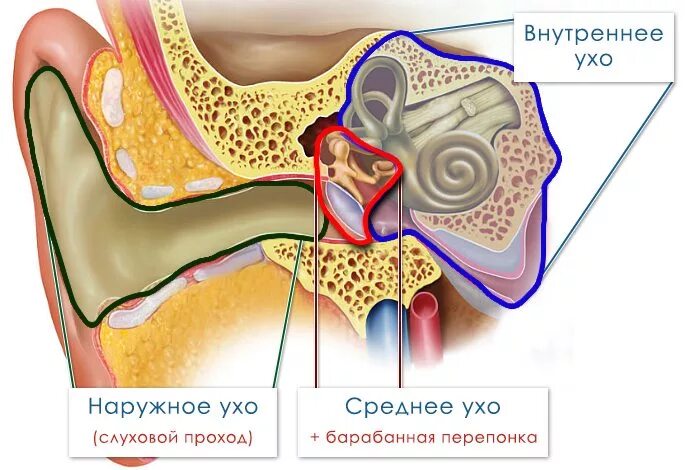 Внутреннее воспаление. Отит воспаление уха внутреннего.