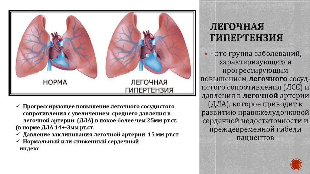 Повышение легочного давления