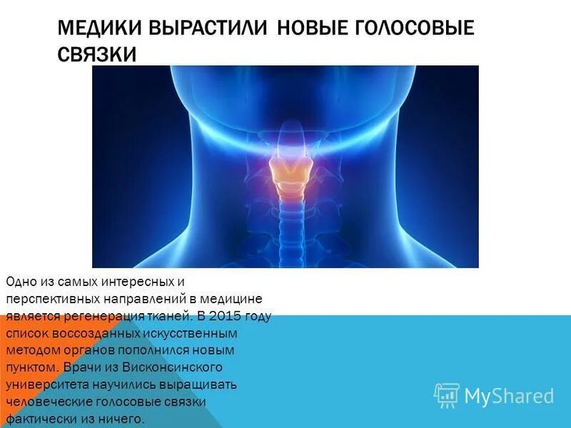 Искусственные голосовые связки. Выращенные голосовые связки. Последний голосовой