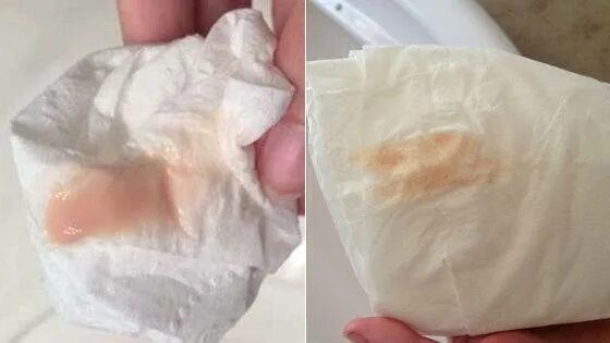 Тянет живот и кровянистые выделения
