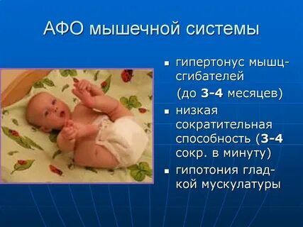 Гипертонус это