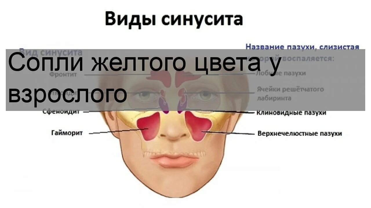 Сопли жёлтого цвета у взрослого. Цвет соплей. Почему желтые сопли у взрослого