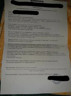 Мажущие выделения после полового акта