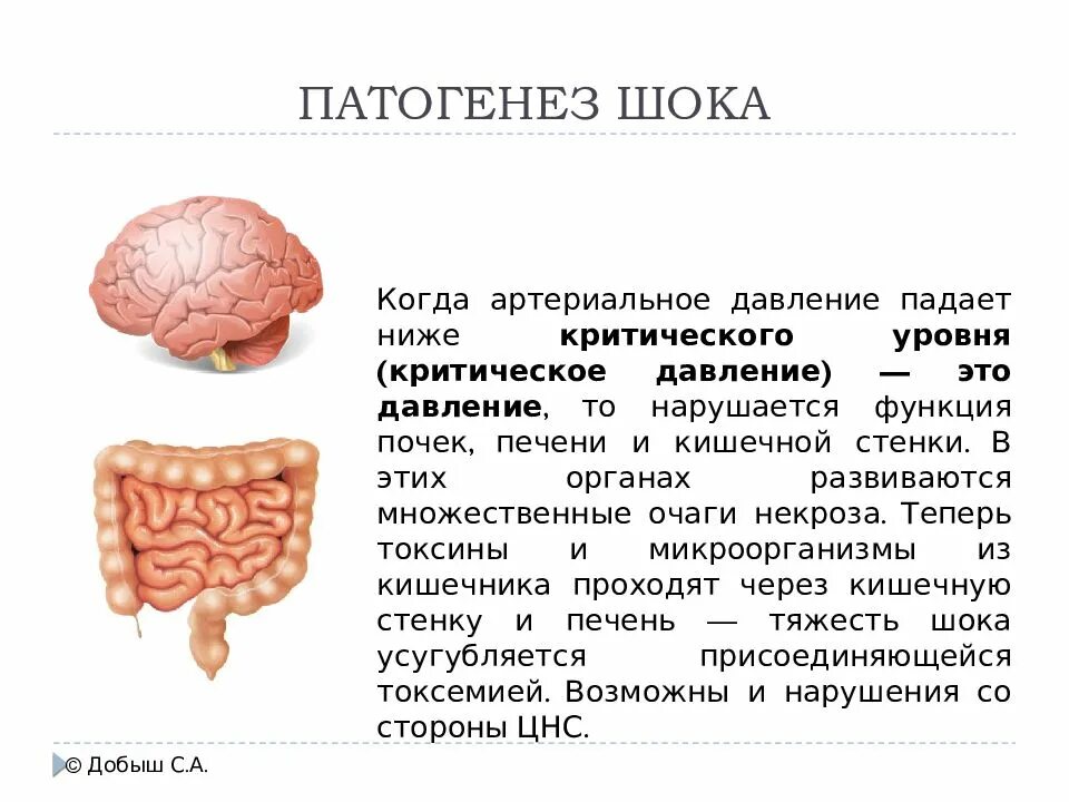 Функции шока. Патогенез шока. механизм развития шока. этиология шока. шок. этиология шока..