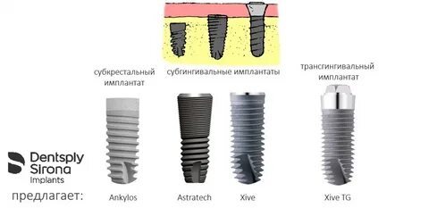 Страна производитель имплантов