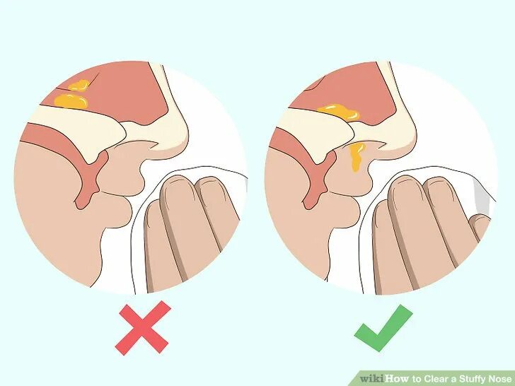Почему не получается высморкаться. Карточка высморкать нос. ВЫСМОРКНУТЬСЯ или высморкаться. Почему нельзя сморкаться