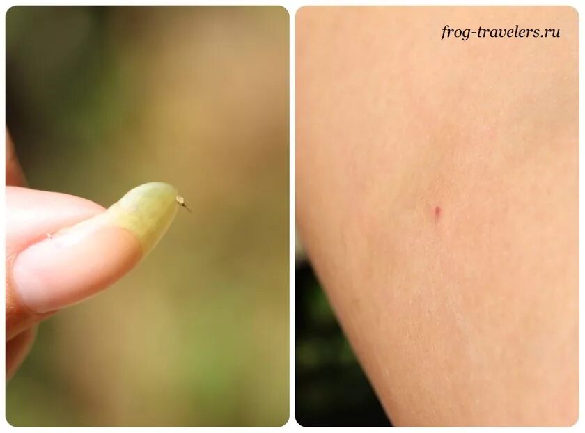 ❗ Rains and high grass led to an increase in tick bites More than 600 have been 