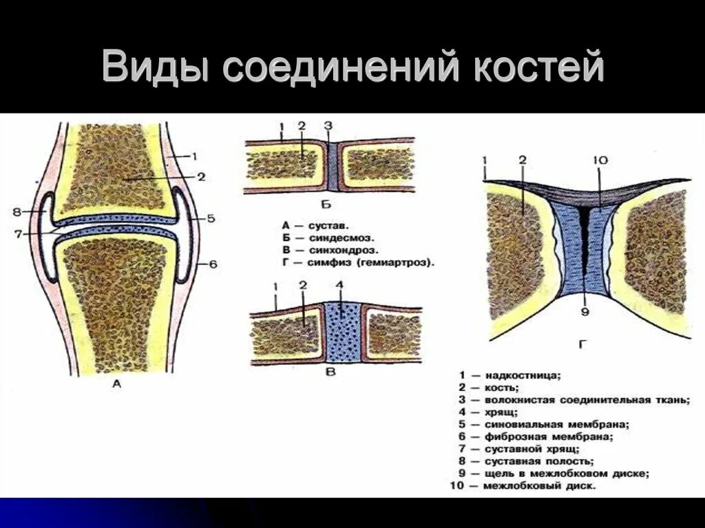 Правильное соединение костей. Соединение костей шов сустав. Непрерывные фиброзные соединения костей рисунок. Непрерывные соединения синдесмоз синхондроз синостоз. Симфиз синдесмоз.