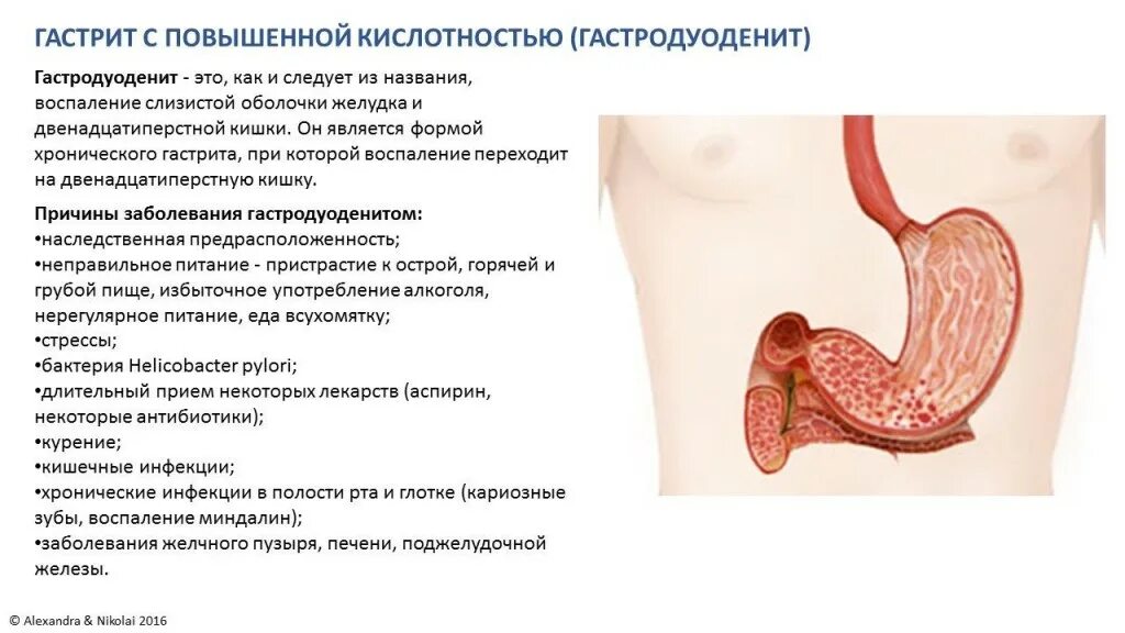 Причины пониженной кислотности. Гастродуоденит пониженной секрецией это. Хронический гастродуоденит с повышенной кислотностью. Хронический гастродуоденит синдромы. Гастрит повышенная кислотность.