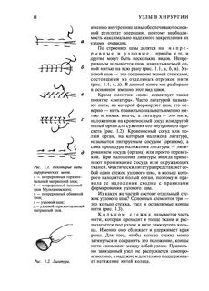 Узел шва