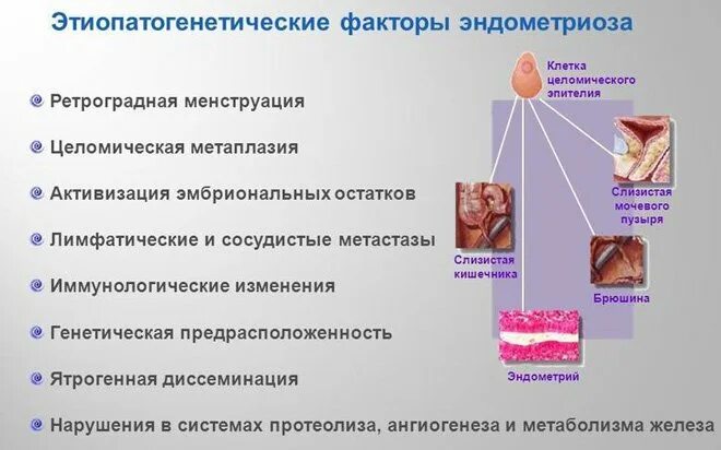 Гипоплазия эндометрия. Гиперплазия и гипоплазия эндометрия. Гипоплазия эндометрия матки. Пролиферативная гипоплазия эндометрия. Гипоплазия эндометрии лечение