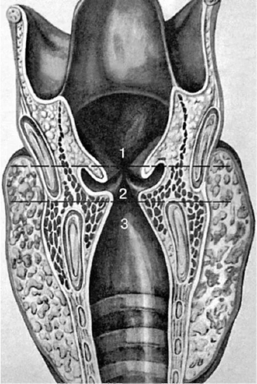 Гортань впр. Морганиевы желудочки гортани рудимент. Черпаловидные хрящи гортани опухоль.
