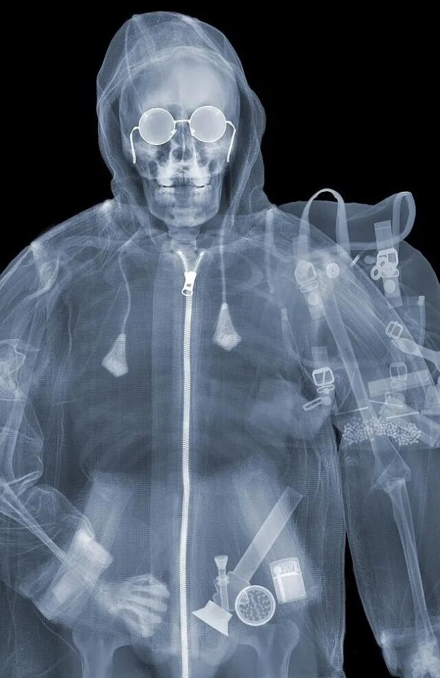 Рентгеновские снимки Ника визи:. Ник визи. X-ray men. Рентген Nick Veasey. Необычные рентген снимки.