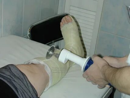 Процедура сапожок