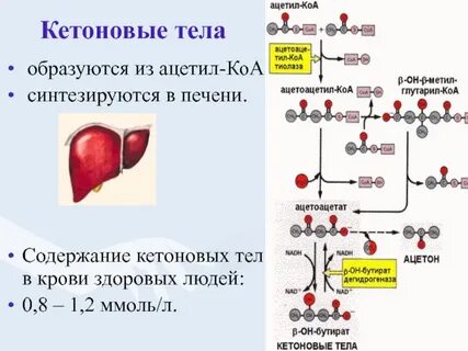 Кетоновые тела отрицательно