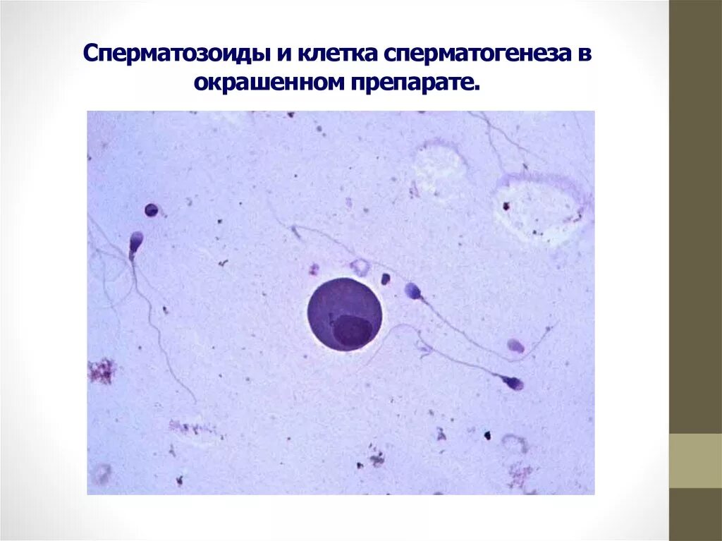 Где образуются спермии