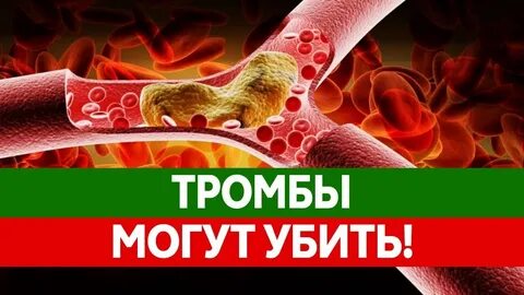 Источники тромбов