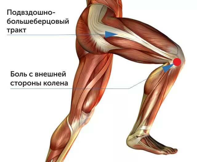 Синдром подвздошно большеберцового тракта. Нагрузка на суставы при беге. Синдром илиотибиального тракта колена. Большеберцовый тракт анатомия. Илиотибиальный тракт синдром.