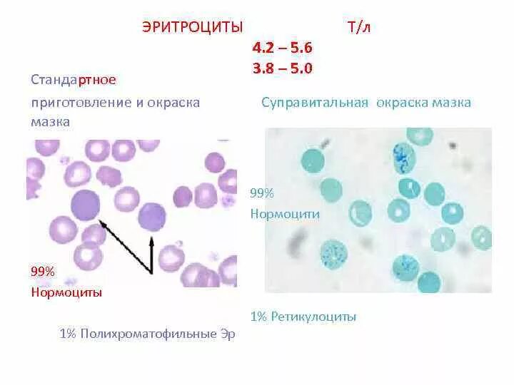 Ретикулоциты 9. Ретикулоциты 9