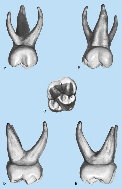 Первый моляр верхней челюсти. Maxillary second molar. 16 Моляр верхней челюсти. Первый моляр верхней челюсти из пластилина. Второй моляр верхней челюсти из пластилина.