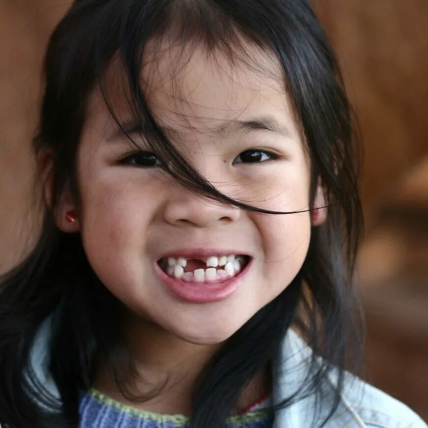 Исправление прикуса у детей. Зубы подростка. Кривые зубы у детей 7. Кривые зубы у детей 7. Кривые зубы у детей 7.