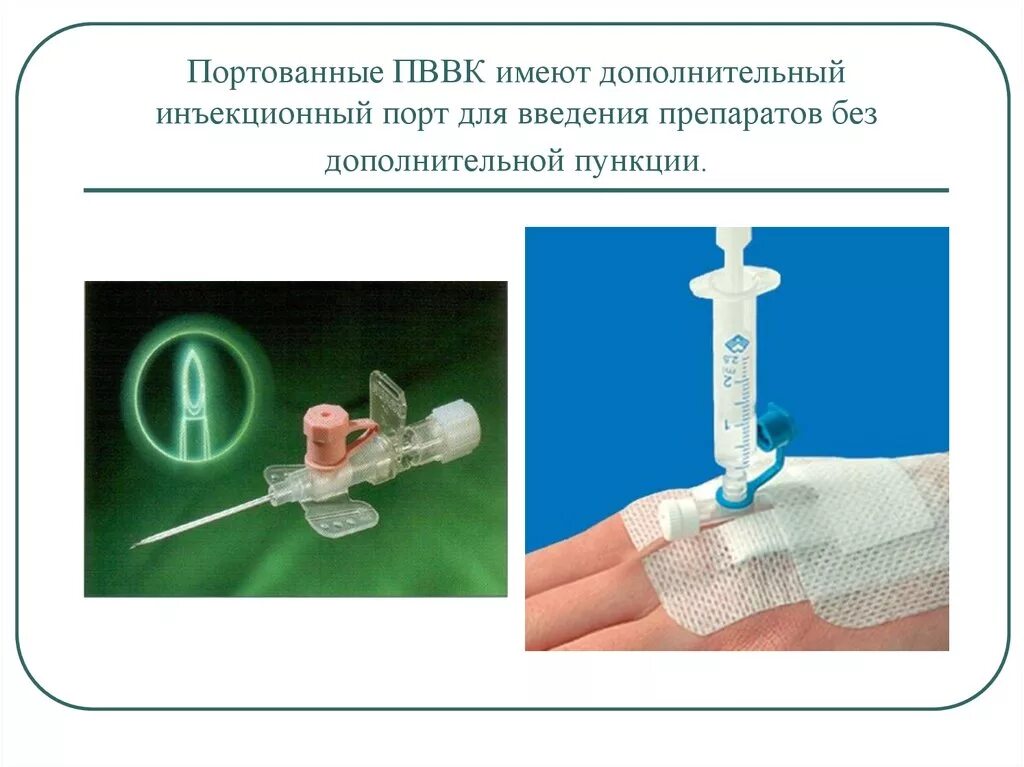 Заполнение внутривенной системы алгоритм. Периферический внутривенный (венозный) катетер (ПВК) -. Венфлон катетер венозный. Промывание внутривенного катетера алгоритм. Катетер внутривенный схема.