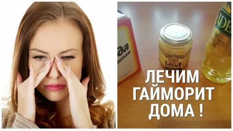 Гайморит как лечить взрослому домашними средствами
